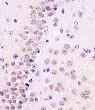 TBP Antibody