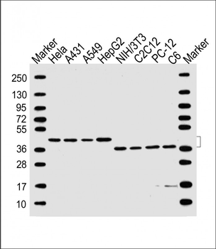 TBP Antibody