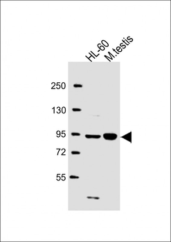 ENASE Antibody (Center)