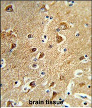 PPM1H Antibody (Center)