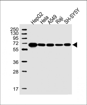 IGF2BP2 Antibody (C-term)