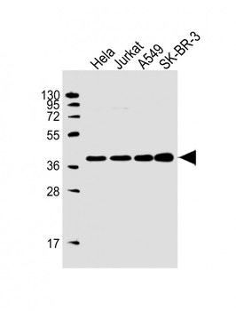 HDGF Antibody (C-term)