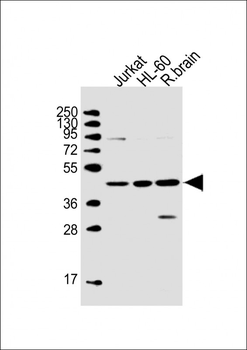 GPR88 Antibody (C-term)