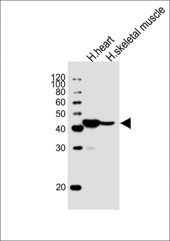 HFE2 Antibody (Center)