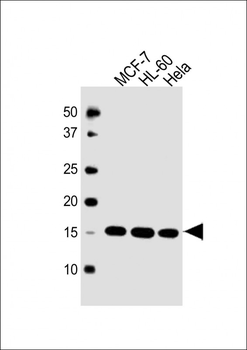 SNRPD3 Antibody (C-term)