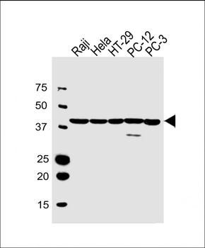 VPS37C Antibody (Center)