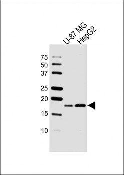 RPS15 Antibody (N-term)