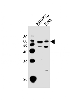 Mouse Cdk8 Antibody (C-term)