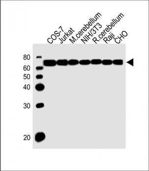 ACHE Antibody (C-term)