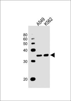 RHOXF2B Antibody (Center)