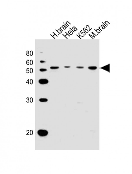 PIP4K2A Antibody (C-term)