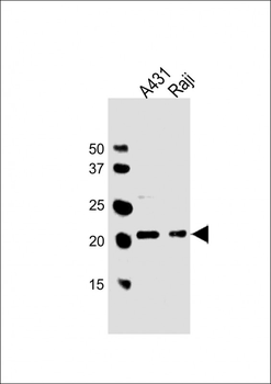 PSMB9 Antibody (C-term)