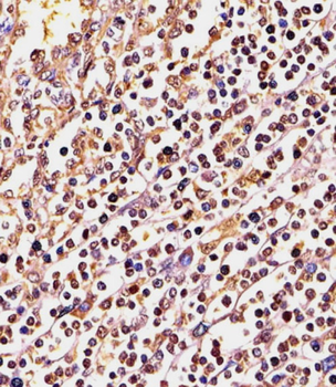 PSMB9 Antibody (C-term)
