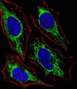 GLS Antibody (C-term)
