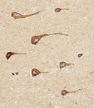 EREG Antibody (C-term)