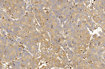 PINK1 Antibody