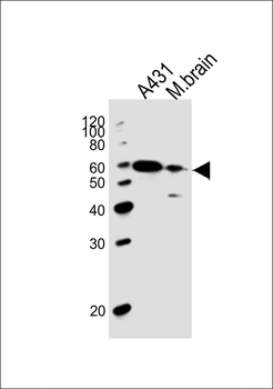 PINK1 Antibody