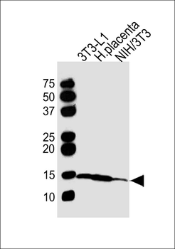 FABP4 Antibody