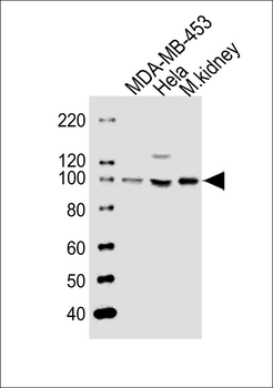 NCOA7 Antibody (N-term)