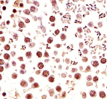 Mouse Ctr9 Antibody (C-term)