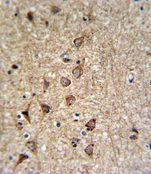 SLC25A37 Antibody (C-term)