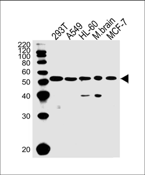 DKK3 Antibody (N-term)