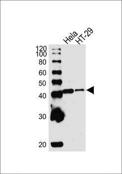 Maspin Antibody (Center)