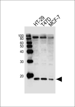 AGR2 Antibody (N-term)