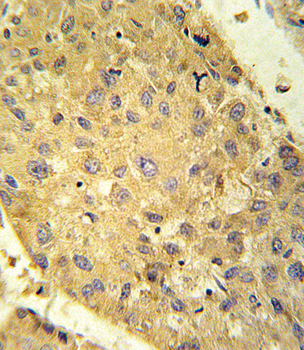 GLS2 Antibody (C-term E513)