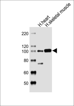 LRP12 Antibody (C-term)