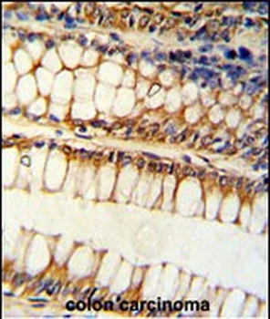 BCL2L11 Antibody (Center)