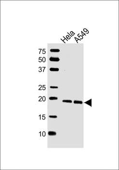 CAV2 Antibody (N-term)
