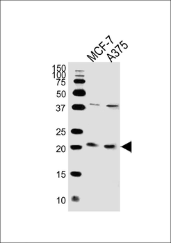 NRAS Antibody (C-term)