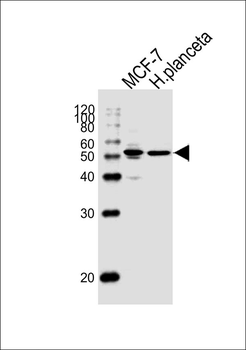 ESR2 Antibody(C-term)
