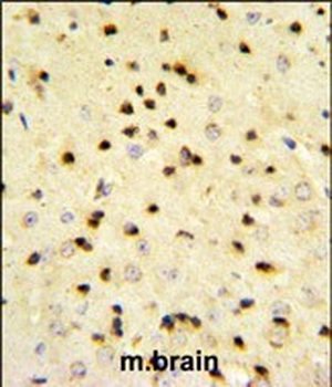 EBP1 Antibody (Center)