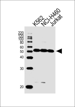 CHEK2 Antibody (N-term)