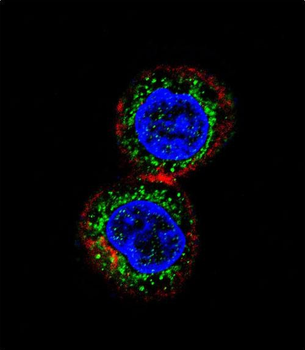 CHEK2 Antibody (N-term)
