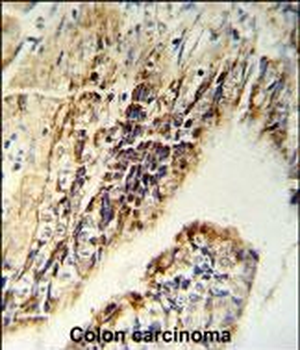 CHEK2 Antibody (N-term)