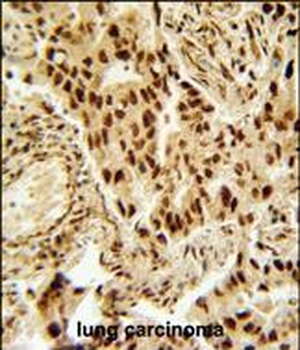 HDAC2 Antibody (Center)