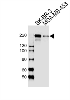 ERBB2 Antibody