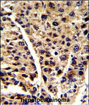 ENOB Antibody (Center)