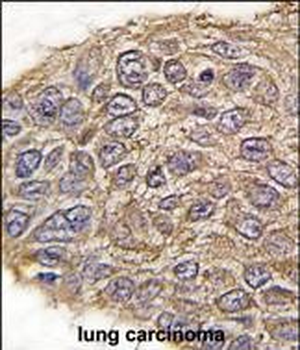 Aldolase (ALDOA) Antibody (N-term)