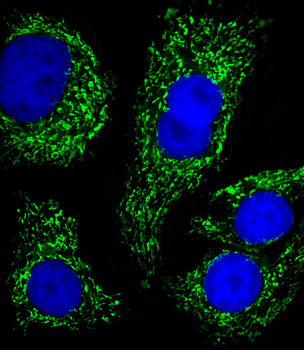 ATP5B Antibody (Center)