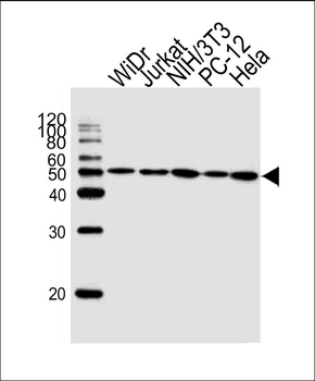 ATP5B Antibody (Center)