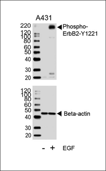 Phospho-ErbB2(Y1221) Antibody