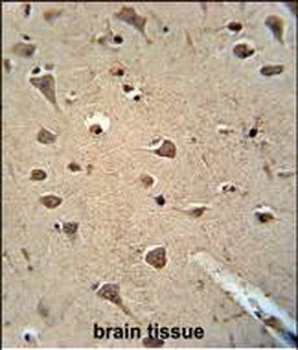 ALDH2 Antibody