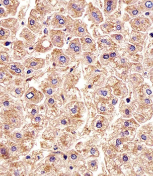 CTSD Antibody
