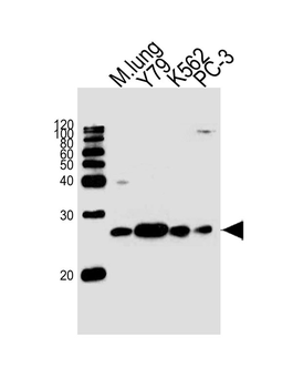 GSTP1 Antibody (Center)