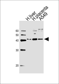 OLR1 Antibody (Center)