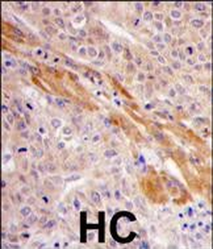 PGK1 Antibody (Center S320)